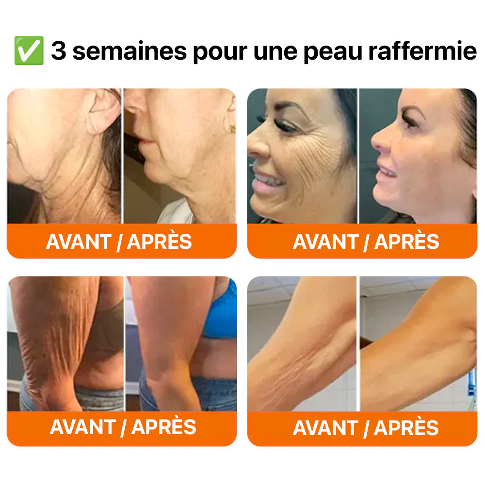 Stick Botox Raffermissant au Venin d’Abeille