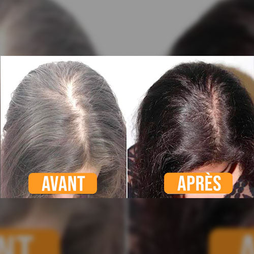 Shampoo Solide Repousse Extrême