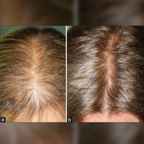 Shampoo Solide Repousse Extrême